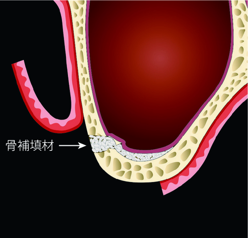 図D-４_00.jpg