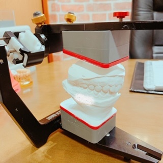 はぎしりの診断