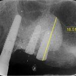 0000007649_大塚-勇夫_IntraOral_20210519180457