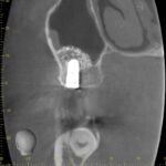 XSlice_20221026_1137