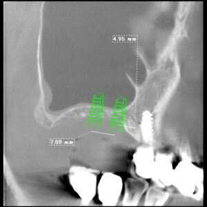 TEAM MASSIVE（チームマッシブ） 先進Dr 3人によるチームオペ